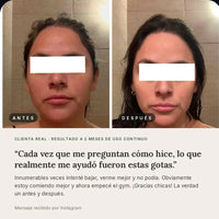 PurezaDrops™ | Drena Naturalmente la Hinchazón del Rostro, Abdomen y Piernas